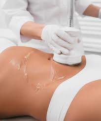 combo lipocavitation et radiofréquence LIPOCAVITATION,80K,radiofréquence,combo lipo 5D et radiofréquence,soin minceur, technique minceur,la louvière